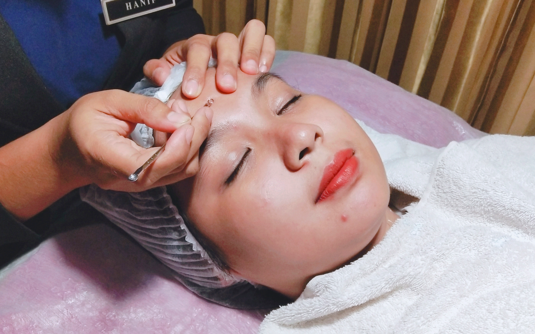 FACIAL
